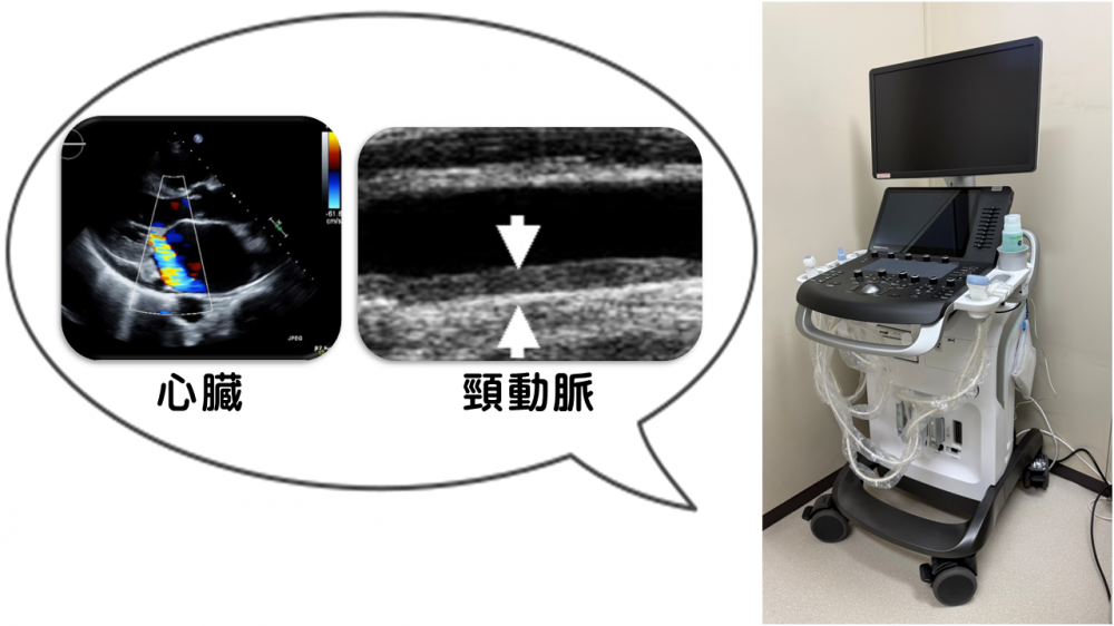 エコー検査について